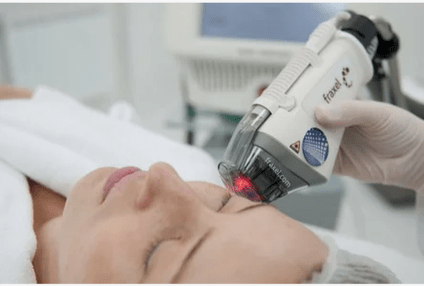 Peremajaan laser